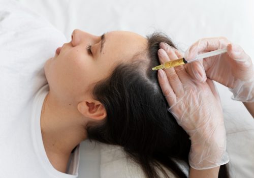 woman-getting-scalp-prp-treatment-high-angle
